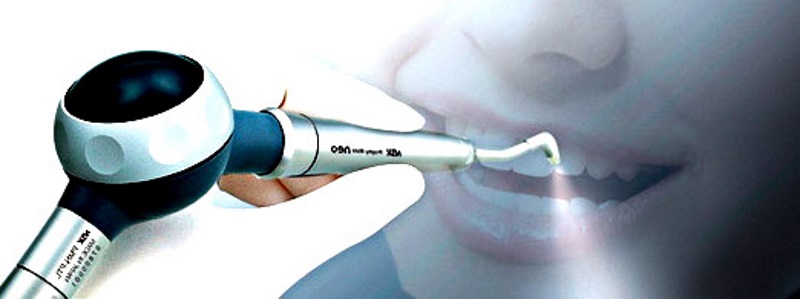 Профессиональная гигиена Air Flow - 1500р.