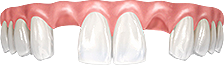 Травма зубов